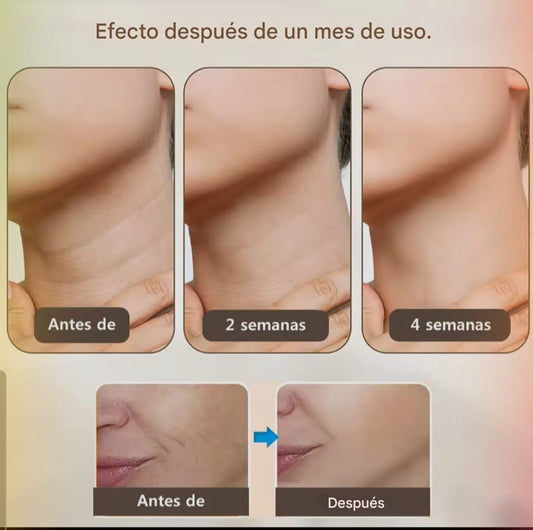 GlowLift, Masajeador Rejuvenecedor, Adiós a Las Arrugas